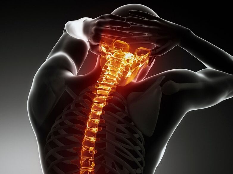 Sintomi di osteocondrosi