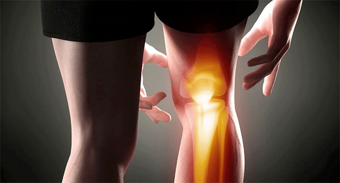 dolore alle articolazioni del ginocchio
