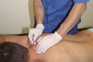 Trattamento passivo dell'osteocondosi