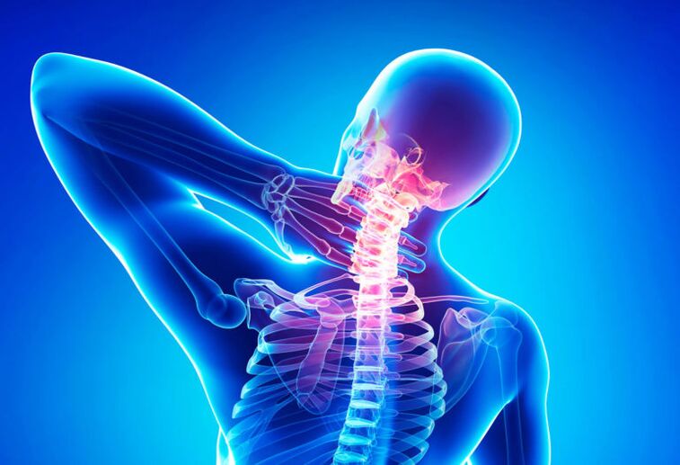 Osteocondrosi della colonna cervicale