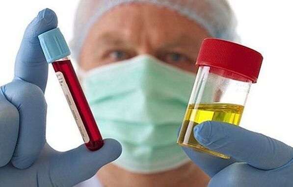 Modi per diagnosticare l'osteocondosi della colonna cervicale