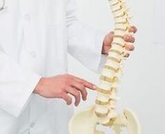 osteocondrosi lombare