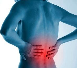 osteocondrosi lombare