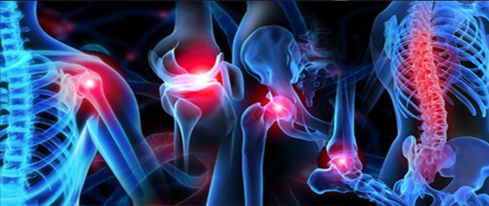 Lesioni articolari